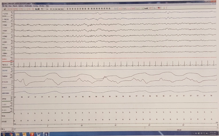 Sleep chart